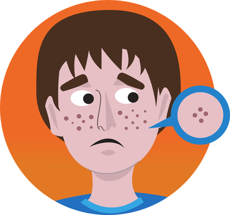 Criteri di scelta per gli integratori contro l'acne